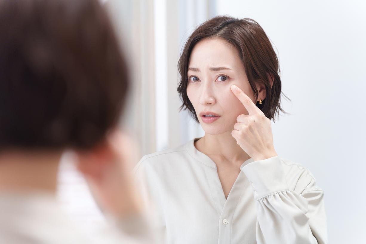 Plpebras Descadas (1)