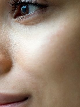 acido-hialuronico-um-reforco-de-hidratacao-para-todas-as-idades-hero