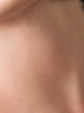 guia-para-eliminar-manchas-escuras-da-pele-hero