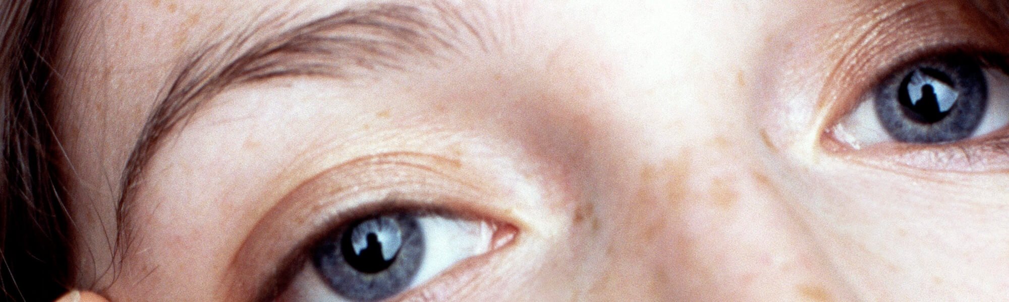 como-escolher-o-corretor-certo-para-eliminar-as-olheiras-hero