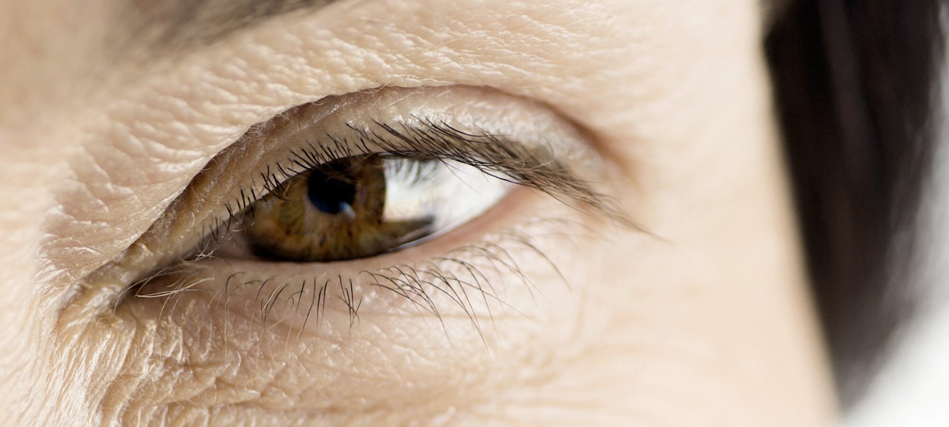 chegou-aos-40-esta-na-hora-de-lidar-com-as-indesejadas-rugas-hero