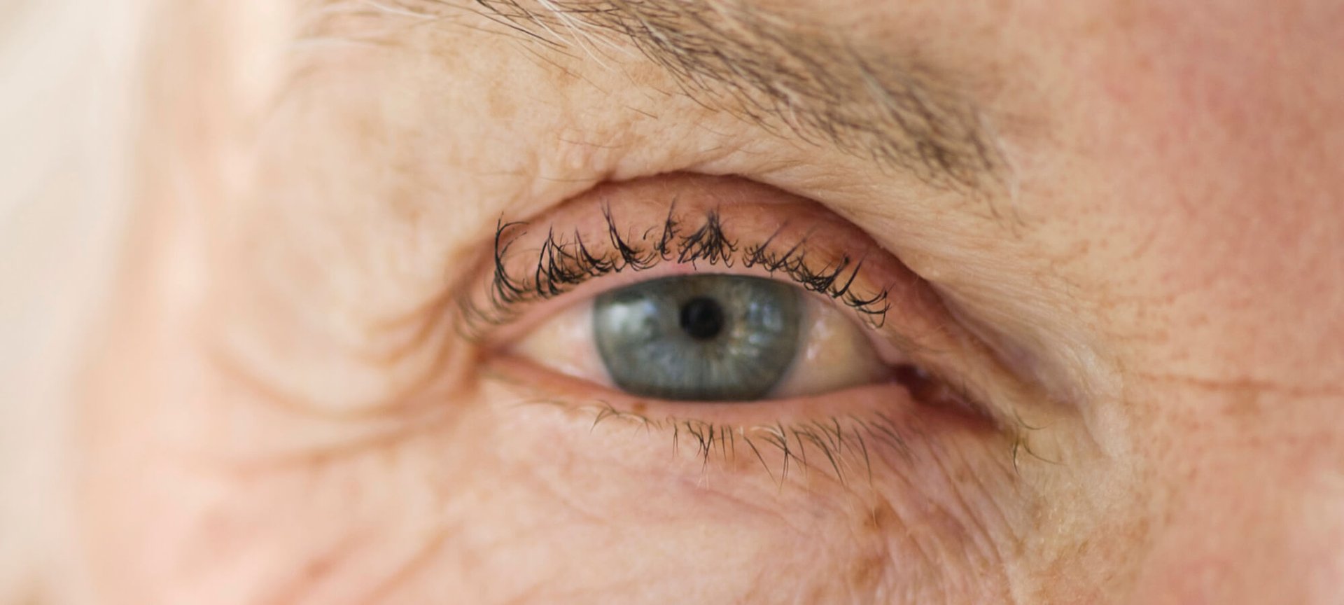 livre-se-das-rugas-com-a-fototerapia-hero