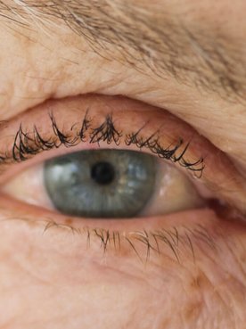 livre-se-das-rugas-com-a-fototerapia-hero