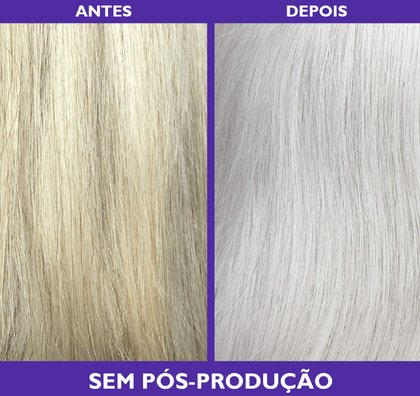 Antes E Depois White