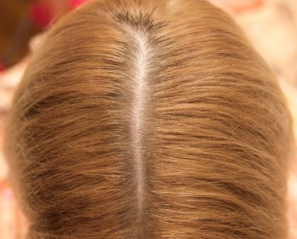 BLOND APRES MAGIC RETOUCH