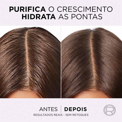 5 DG72518 ATF PT