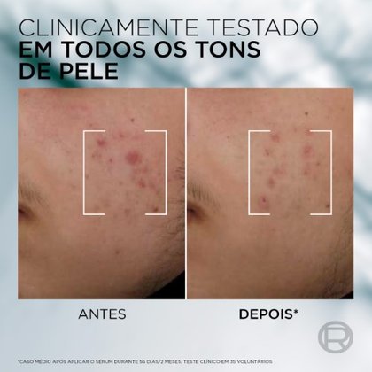 DG94031 ATF SERUM 2 2400x2400