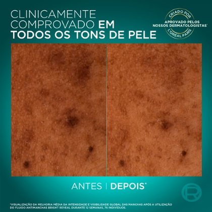36005241226762 Personalizado