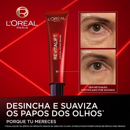 Eyebag Laser Pt