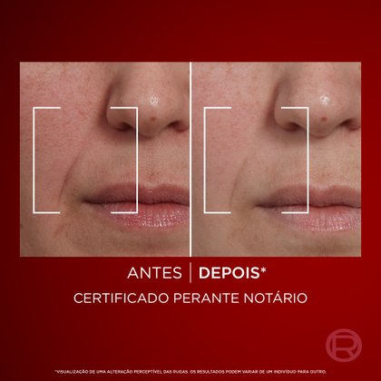 Revitalift Laser 3 Personalizado